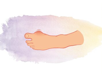 En teckning av en mänsklig fot med en synlig svullnad vid stortån mot en pastellfärgad bakgrund. | © Gabor Shoes GmbH, Tyskland